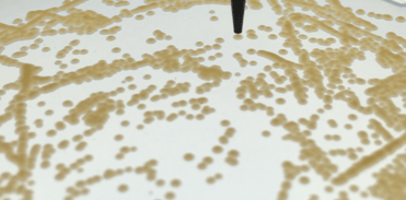 The Blog | Automation removes the colony-picking bottleneck